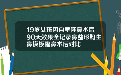 19岁女孩因自卑隆鼻术后90天效果全记录鼻整形妈生鼻模板隆鼻术后对比